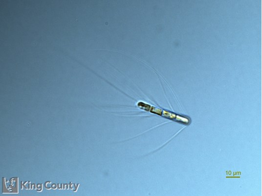 Photo of Chaetoceros subtilis